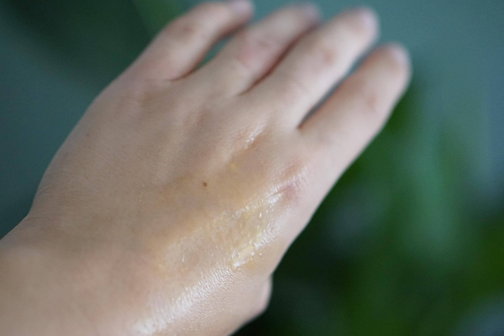 welke olie is goed voor je huid